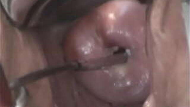 Cervical insertion. Fucking in the uterus
