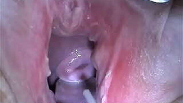 Injecting sperm into the cervix with a syringe after fucking